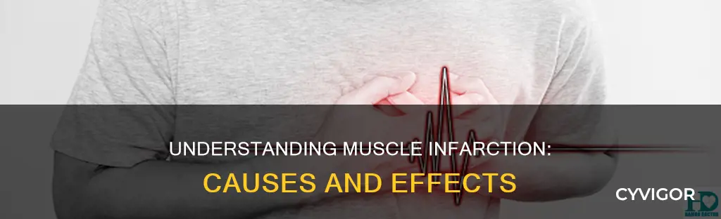 what is a muscle infarction