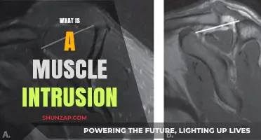 Understanding Muscle Intrusions: What, Why, and How?