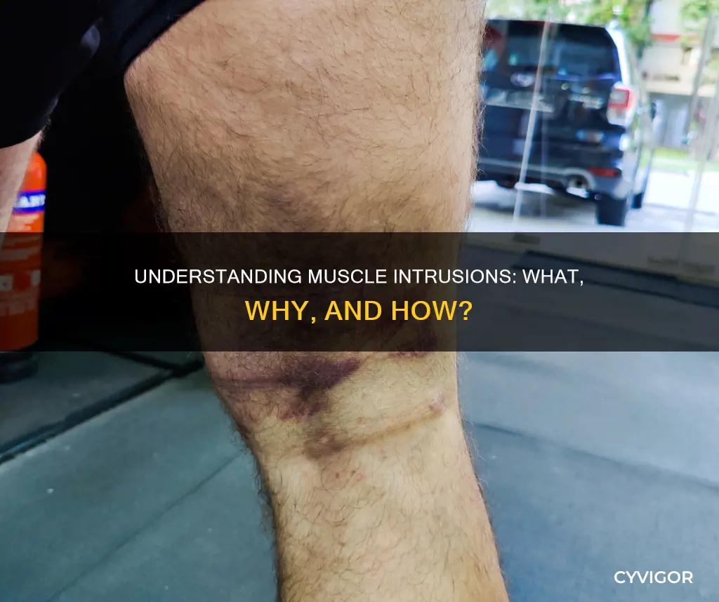 what is a muscle intrusion