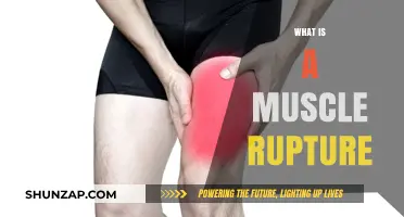 Muscle Rupture: Understanding Tears and Treatment
