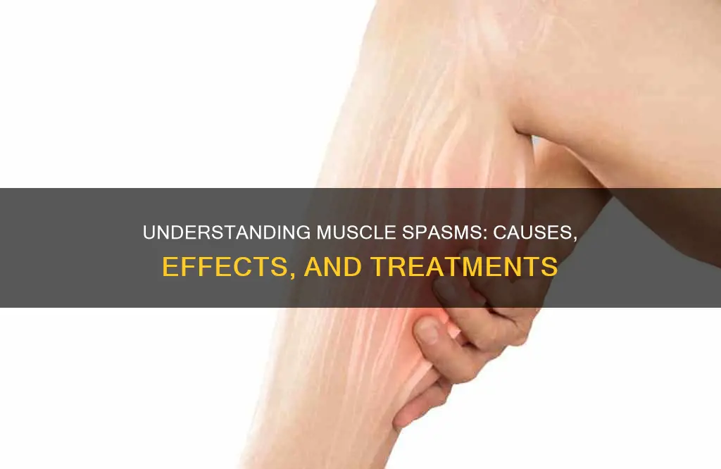 what is a muscle spams