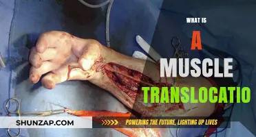 Muscle Translocation: Understanding the Procedure and Its Benefits
