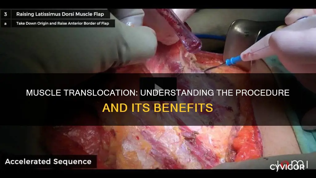 what is a muscle translocation