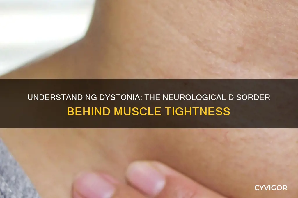 what is a neurological disorder that causes muscle tightness