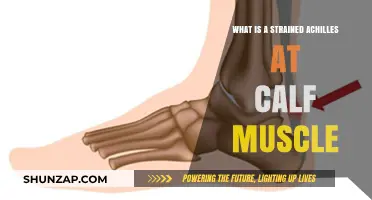Understanding Strained Achilles: Causes, Symptoms, and Effective Treatments