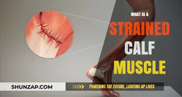 Understanding Strained Calf Muscles: Causes, Symptoms, and Recovery Tips