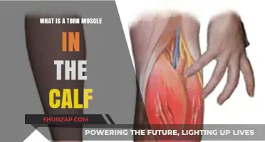Understanding Calf Muscle Tears: Causes, Symptoms, and Recovery