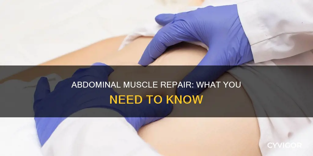 what is abdominal muscle repair