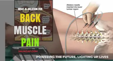 Understanding Ablation Therapy for Chronic Back Muscle Pain Relief