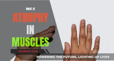 Understanding Muscle Atrophy: Causes and Effects
