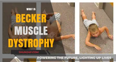 Understanding Becker Muscular Dystrophy: Symptoms and Causes