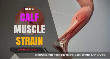 Understanding Calf Muscle Strain: Causes, Symptoms, and Effective Treatments