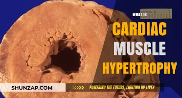 Understanding Cardiac Muscle Hypertrophy: Heart Muscle Growth