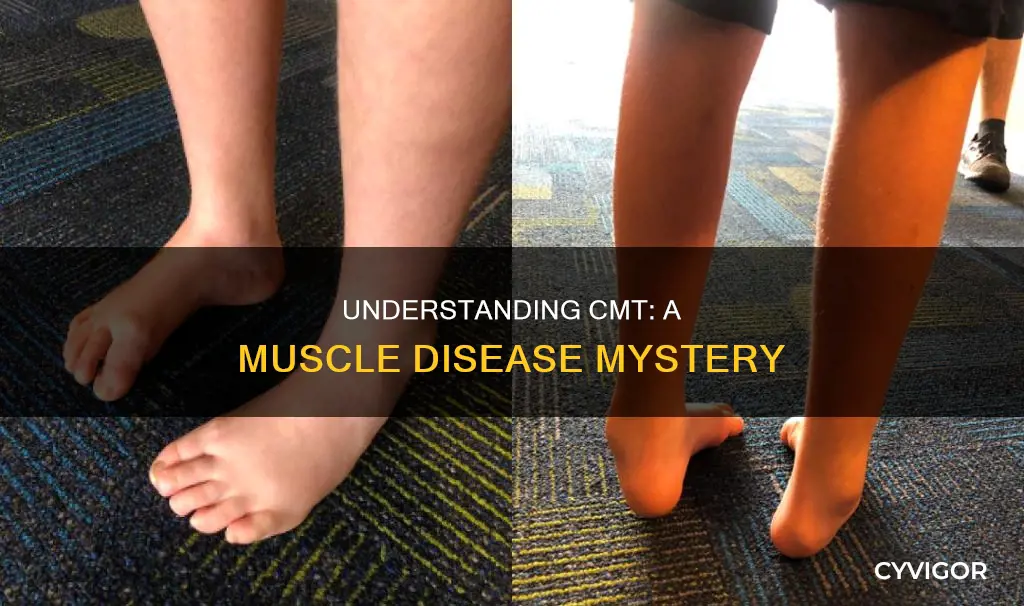 what is cmt muscle disease
