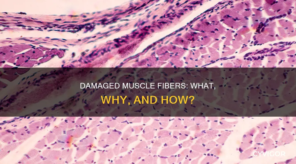 what is damaged muscle fibers