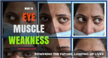 Understanding Eye Muscle Weakness: Causes and Treatments