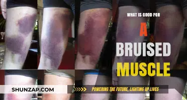 Soothing Remedies: What's Good for a Bruised Muscle?