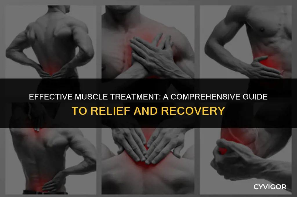 what is good treatment for muscles