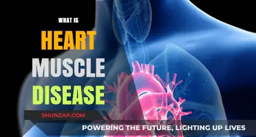 Understanding Heart Muscle Disease: Causes and Treatments