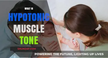 Understanding Hypotonic Muscle Tone: Causes and Effects