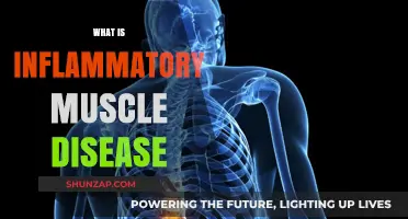 Understanding Inflammatory Muscle Diseases: Causes and Treatments
