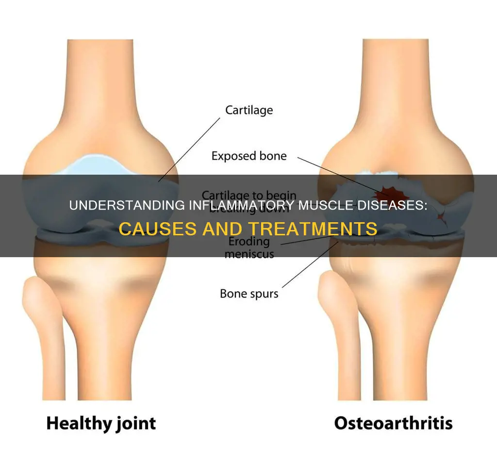 what is inflammatory muscle disease