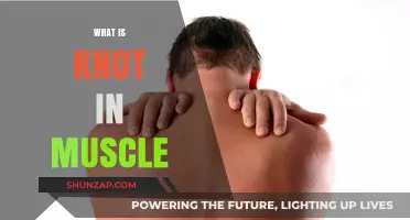 Understanding Muscle Knots and Their Causes