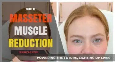Unlocking Masseter Muscle Reduction: A Guide to Slimmer Jaws