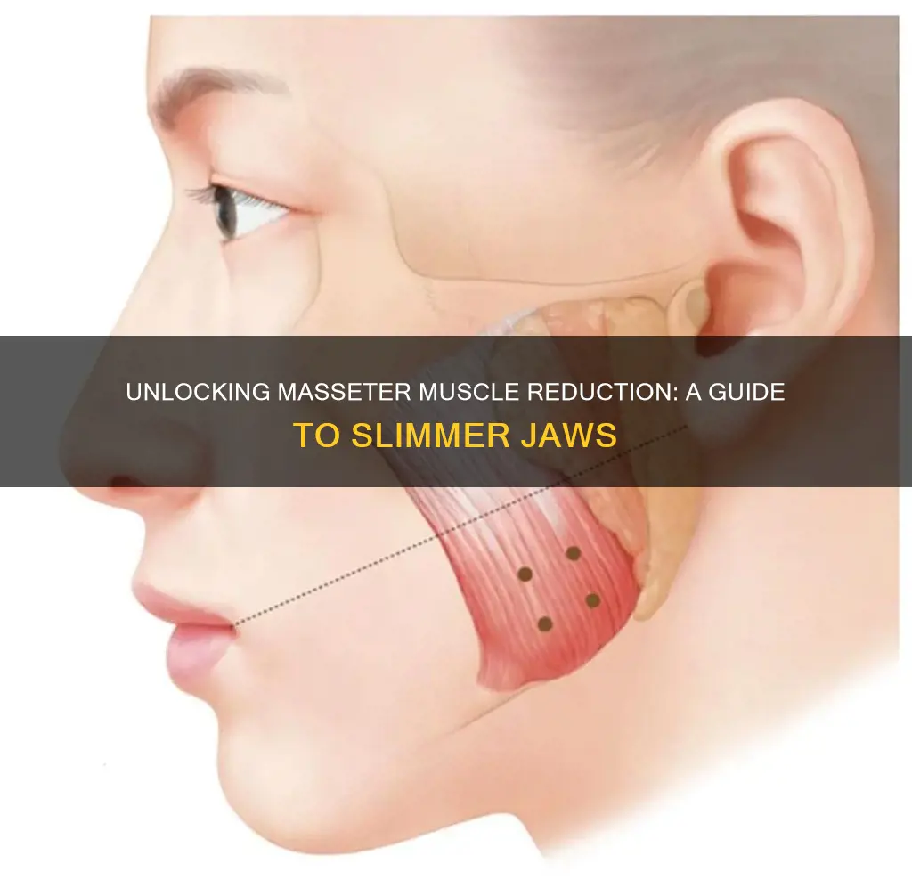 what is masseter muscle reduction