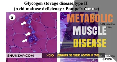 Understanding Metabolic Muscle Diseases: Causes and Treatments