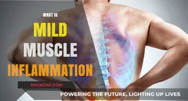 Muscle Inflammation: Understanding Mild Symptoms and Causes