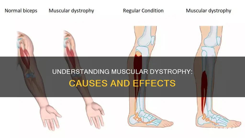 what is musclar dystrophy