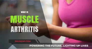 Understanding Muscle Arthritis: Causes, Symptoms, and Treatment