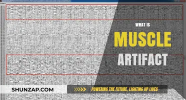 Understanding Muscle Artifacts: What Are They?