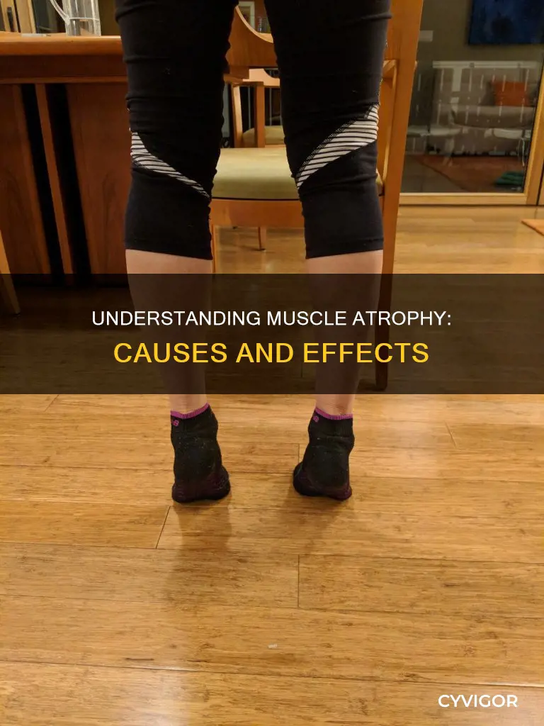 what is muscle ateophy