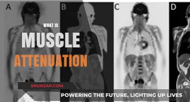 Understanding Muscle Attenuation: Building a Strong Foundation