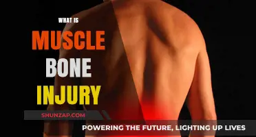 Understanding Muscle and Bone Injuries: Causes and Treatments