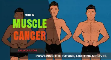 Understanding Muscle Cancer: Causes, Symptoms, and Treatments