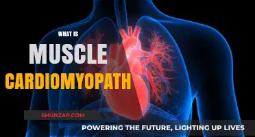 Understanding Muscle Cardiomyopathy: Symptoms and Causes