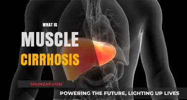 Understanding Muscle Cirrhosis: Causes, Symptoms, and Treatment