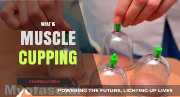 Muscle Cupping: Ancient Technique for Modern Muscle Recovery