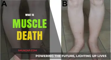 Understanding Muscle Death: Causes and Effects