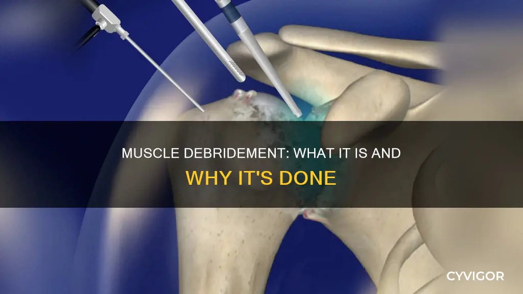 what is muscle debridement