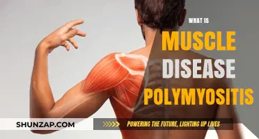 Understanding Polymyositis: A Muscle Disease Mystery