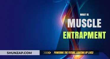 Muscle Entrapment: Understanding the Pain and Treatment Options