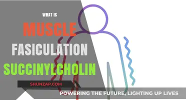 Understanding Muscle Fasciculation and Succinylcholine