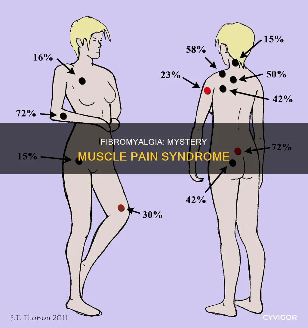 what is muscle fibromyalgia syndrome