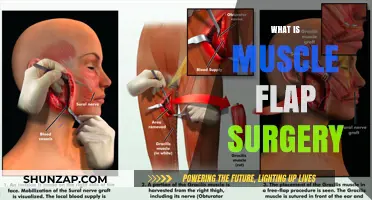 Muscle Flap Surgery: Understanding the Procedure
