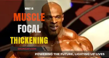 Understanding Muscle Focal Thickening: Causes and Treatment