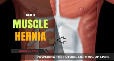 Muscle Hernia: What, Why, and How?